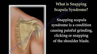 Snapping Scapula Syndrome - Everything You Need To Know - Nabil Ebraheim