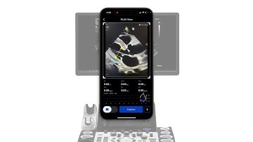 [Vis-CUS] Innovative AI Solution for Cardiac Ultrasound Diagnosis