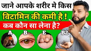 कब कौन सा Multivitamin लेना चाहिए | Best Multivitamin For Your Body | Gyanear