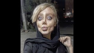 Famous Sahar Tabar: 5 Facts About Teen Who Allegedly Had 50 Surgeries To look Like Angelina Jolie Profile