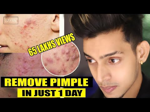 In this video i will show how to remove your pimples and dark spot just 1 day at home easily .i use chandan wood for remedies is true a...