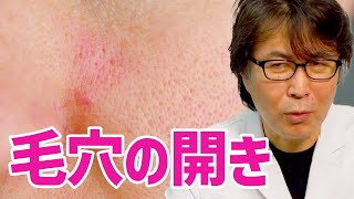 顔、頬の『毛穴開き』が気になる人、毎日使う「アレ」をやめてください