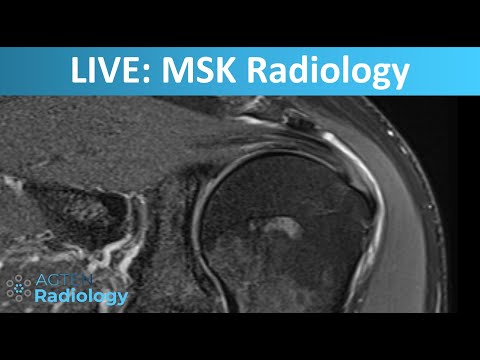 LIVE Stream: MSK Radiology Cases Ep.01