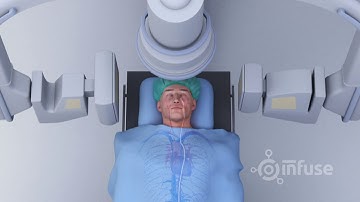 3D Medical Animation - Blood Clot Removal