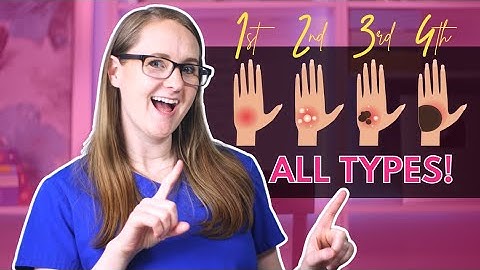 Degree of Burns (1st, 2nd, 3rd, 4th Degree Burn Breakdown)