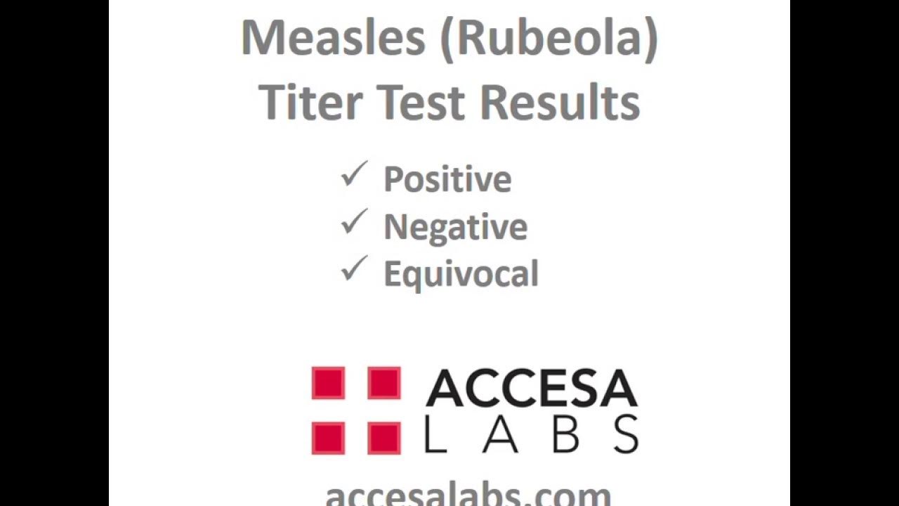 Measles Titer Rubeola Titer Test Results Overview YouTube