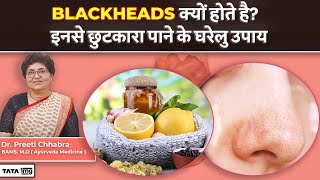 How to Remove Blackheads at Home | Natural Remedies by Dr Preeti Chhabra