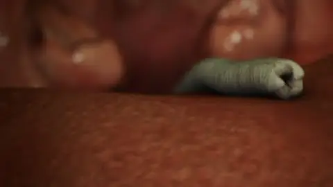 Como ocorre a contaminação de uma pessoa por lombrigas?