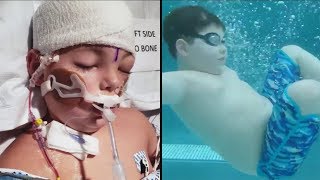 Aquatic therapy, rap music help boy recover from brain aneurysm