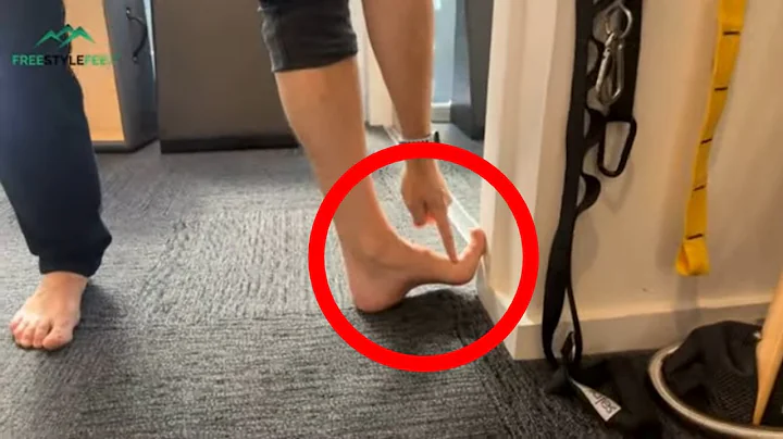 Stiff big toe? 3 tips to avoid surgery