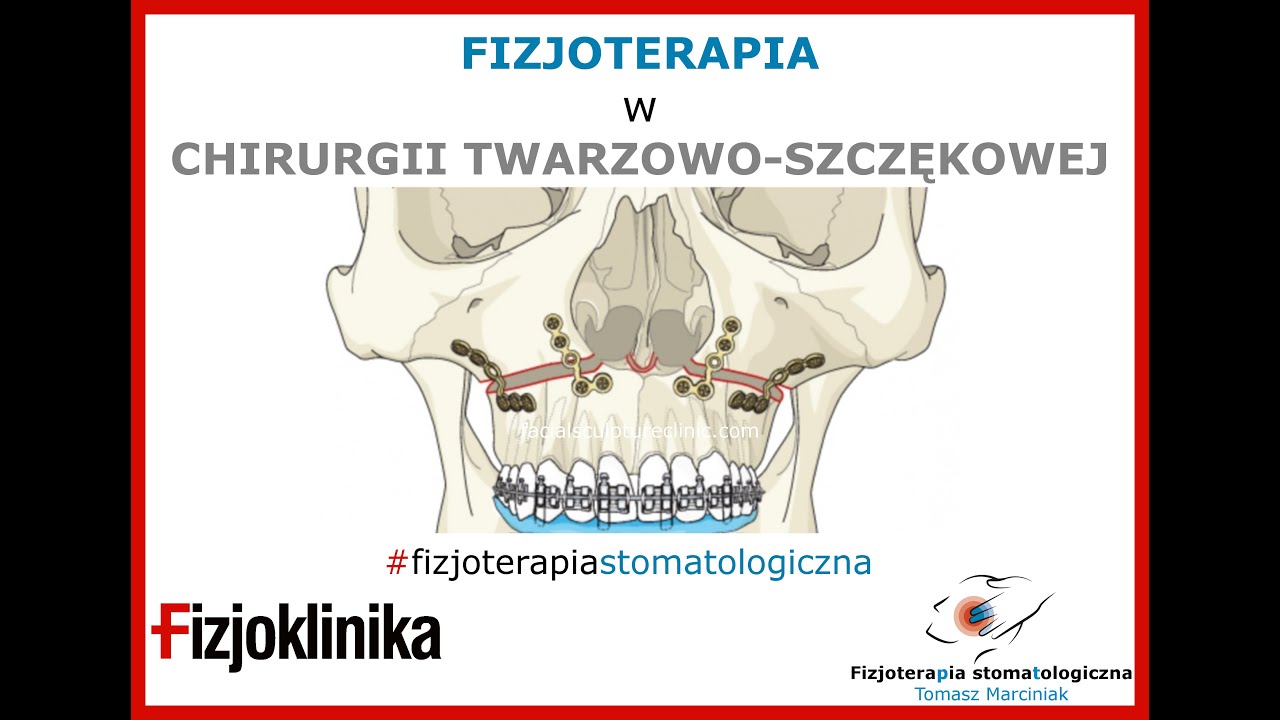 Kinesiotaping - aplikacja przeciwobrzękowa po operacji ortognatycznej. Poradnik dla pacjenta.