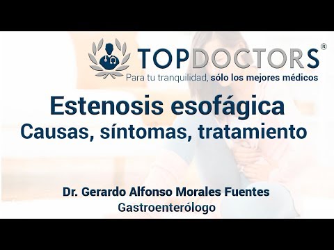 Vídeo: Estenosis Pilórica Y Esofágica: Causas, Estadios, Diagnóstico Y Tratamiento