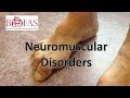 Neuromuscular Disorders of the Foot and Ankle