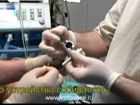 Бандаж на рот видео 174