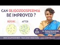 Oligozoospermia  treatment options for low sperm count  dr chekuri suvarchala  ziva fertility