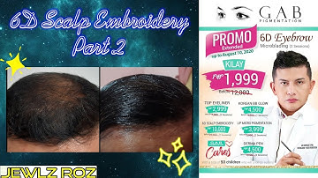6D Scalp Embroidery by GAB Pigmentation Biñan Branch Part 2 - 1st Session (Scalp Microblading)