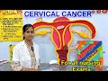 CERVICAL CANCER / Definition/ causes/ symptoms/ Diagnosis/ treatment/ developmental stages/ nursing