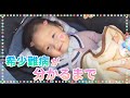 現在の治療薬が使えない脊髄性筋萎縮症