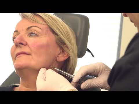 Volumetric Facelift - Non-surgical full facelift