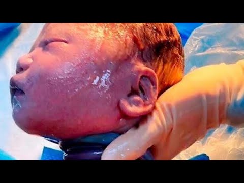 Vidéo: Comment le cordon ombilical est-il connecté au bébé ?