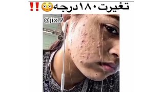 تغيرت 180 درجة / مقاطع انستقرام