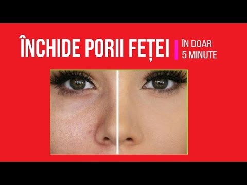 Video: 4 moduri de a închide porii mari