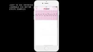 ACLSmed™ ECG Rhythm APP screenshot 2