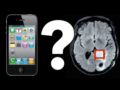 Do Cell Phones Cause Brain Tumors?