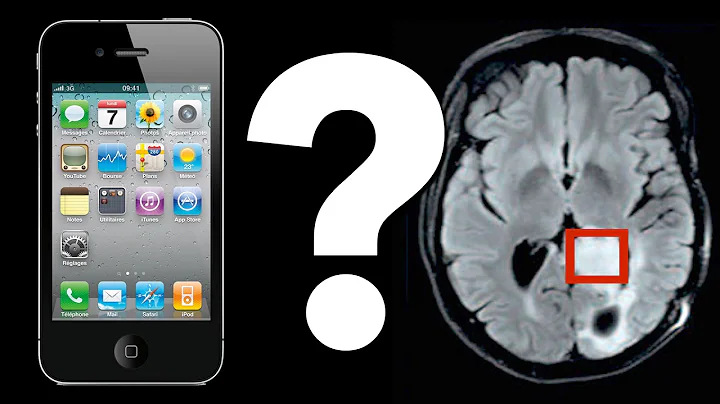 Do Cell Phones Cause Brain Tumors?