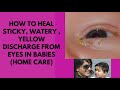 How to heal sticky, watery, yellow discharge from eyes in babies