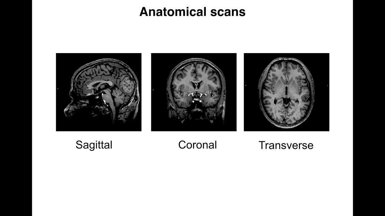 functional mri