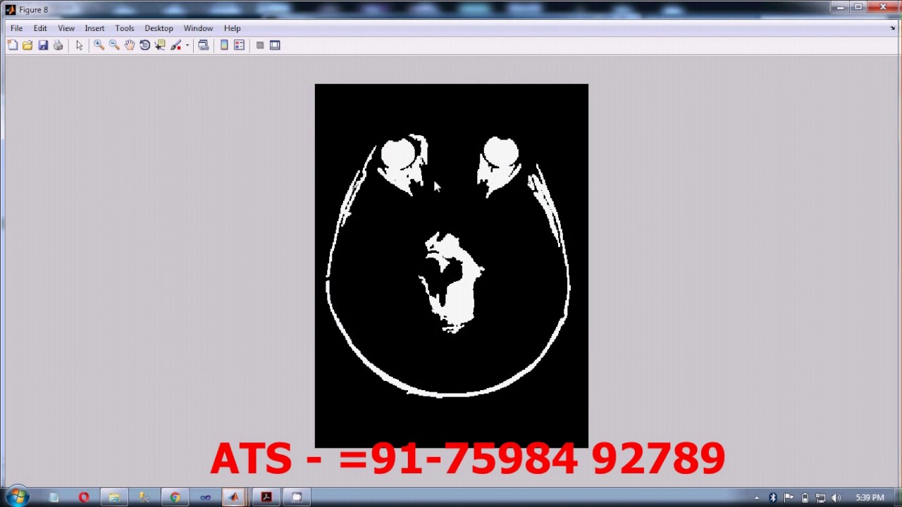 Automatic Brain Tumor Tissue Detection based on Hierarchical Centroid Shape Descriptor