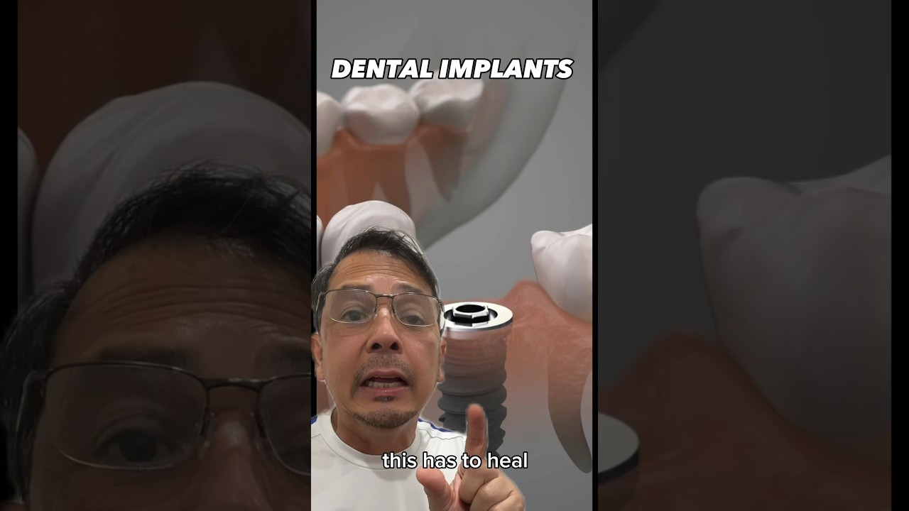 Why Are Dental Implants EXPENSIVE?! (Dentist Explains) | View Mobile Dental