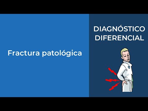 Vídeo: Fractura Patológica: Síntomas, Causas Y Tratamiento