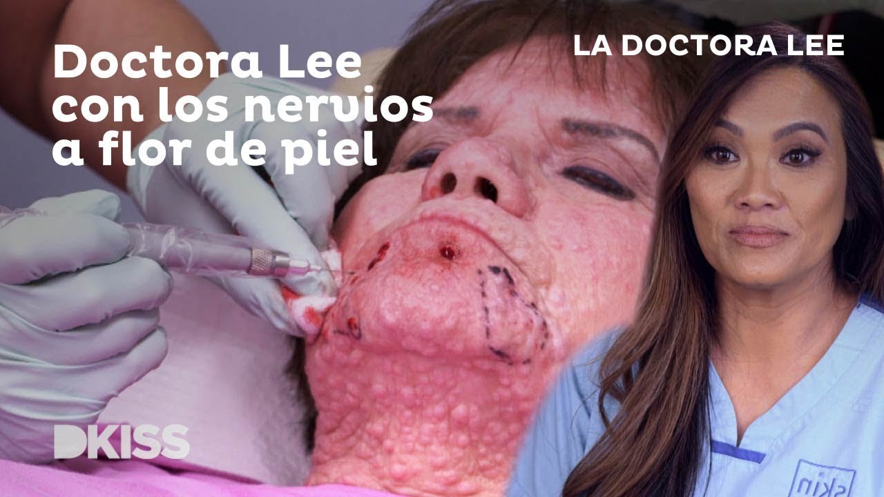 Reventar granos dra lee