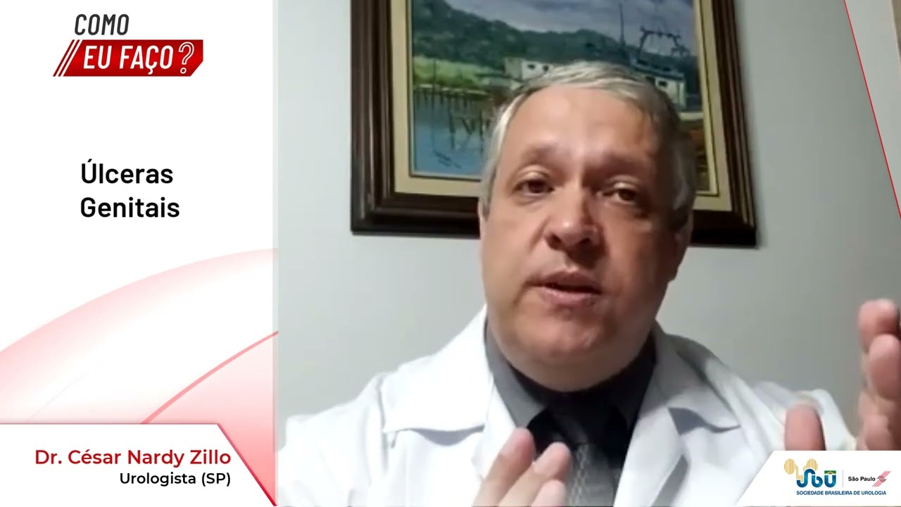 Como eu faço: Úlceras genitais