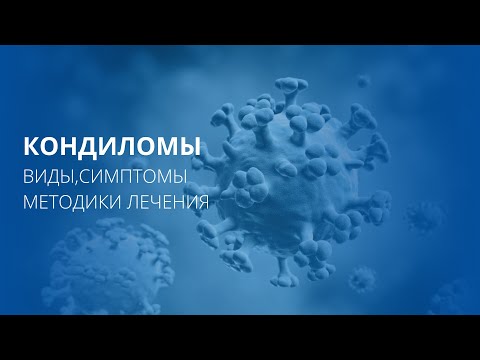 Кондиломы анального канала: виды, симптомы, лечение