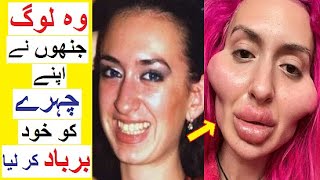 People Who went too far with Cosmetic Surgeries