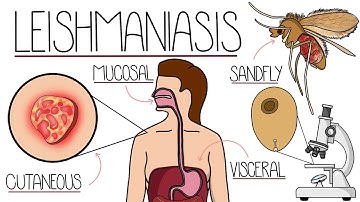 Leishmaniasis Explained Clearly