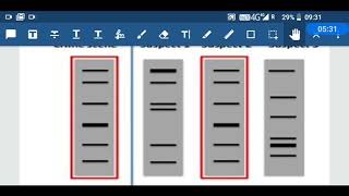 12 1 24 DNA polymorphism