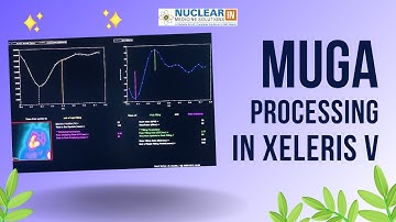 Mastering MUGA Processing with Xeleris 5: Step-by-Step Guide