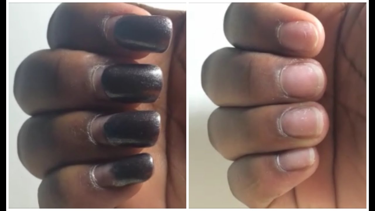 How do you remove acrylic nails at home?