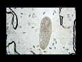 Paramecium in a tight spot