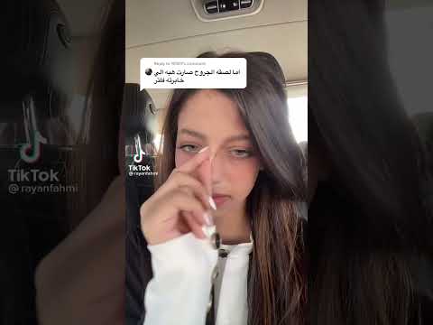 لما ريان فهمي تنجرح في أنفها