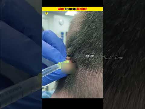 ผลสลากกินแบ่งรัฐบาล วันที่ 1 พย. 2567