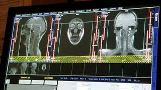 School of Medical Imaging MRI Lab - Soft Tissue Neck screenshot 3