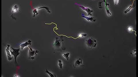 macrophage chemotaxis with tracking