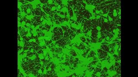 Projection of  Z stack