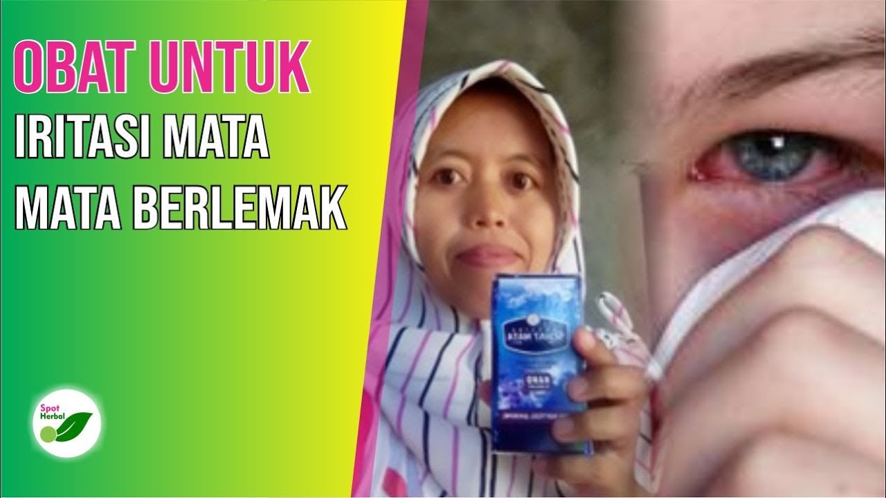 Cara Mengobati IRITASI Pada MATA, Mata Berlemak Secara Alami