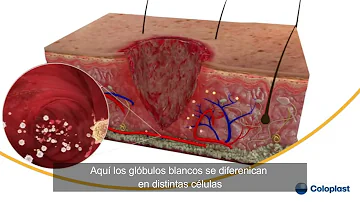 ¿Se produce la cicatrización de la herida por la noche?